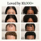 Loved by 10,000+ before and afters