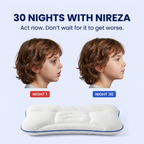 30 nights with Nireza before and after